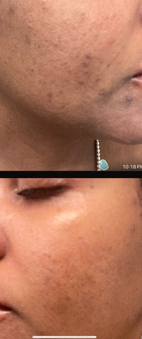 URNU MaxSkinGlow – (Vegan) Pure Radiance | Botanical Glow Booster